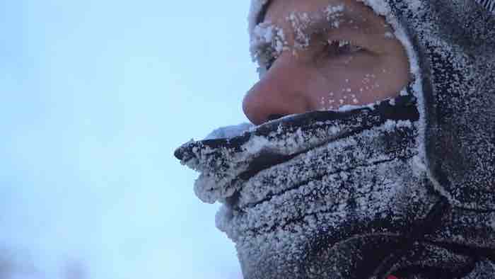 New spray gel could help take the bite out of frostbite
