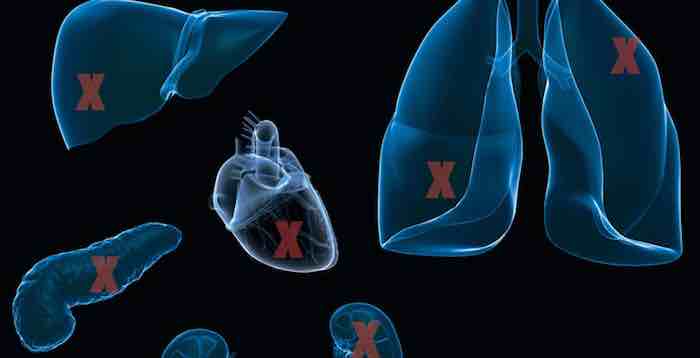 Biomarker tests could someday help improve outcomes for organ transplant patients