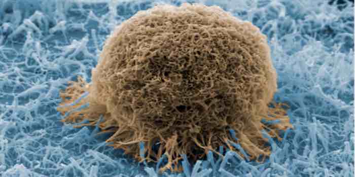 Inexpensive detector is like 'Velcro®' for cancer cells