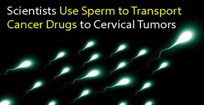 Harnessing sperm to treat gynecological diseases