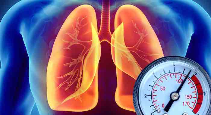 The Perfect Storm for Hypertension