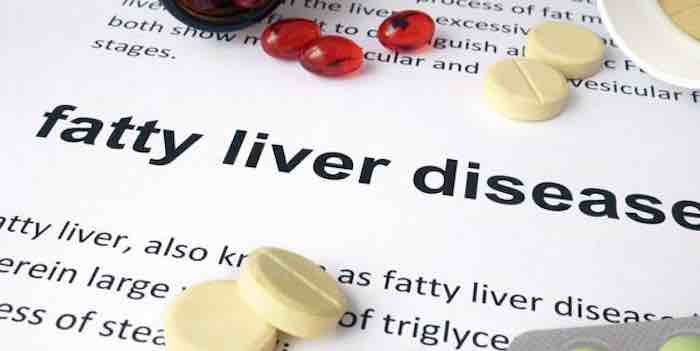nonalcoholic fatty liver disease (NAFLD)