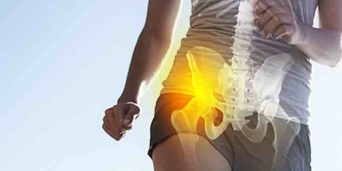 Can Stem Cell Injections Replace Hip and Knee Surgery?