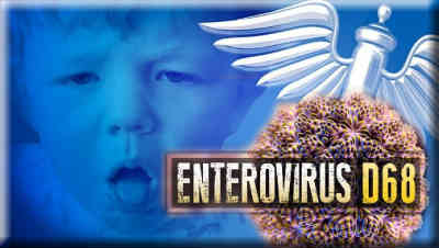 As Obama Tackles Ebola, What About Enterovirus D68