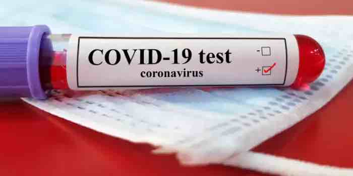 The whole scam just fell apart: COVID test, overwhelming number of false positives