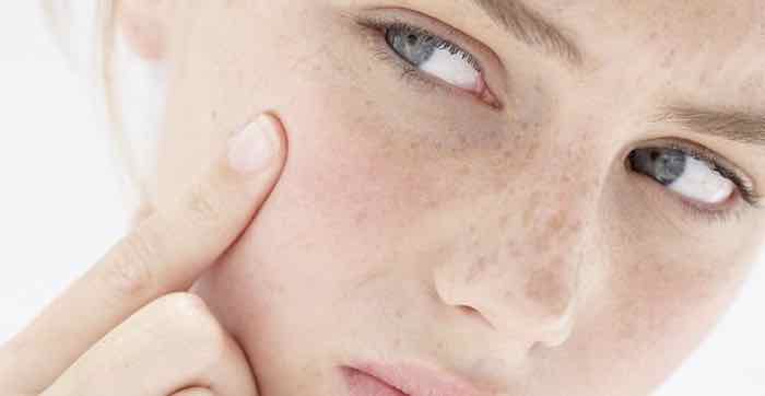 It’s Time to Winterize Skin
