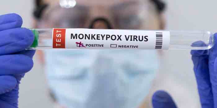 Monkeypox Update